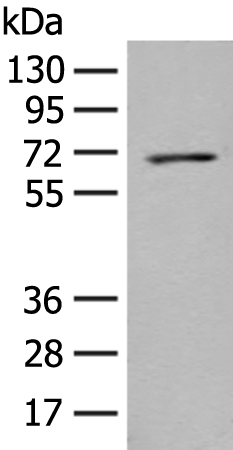 Rabbit Polyclonal Antibody to PPM1D
