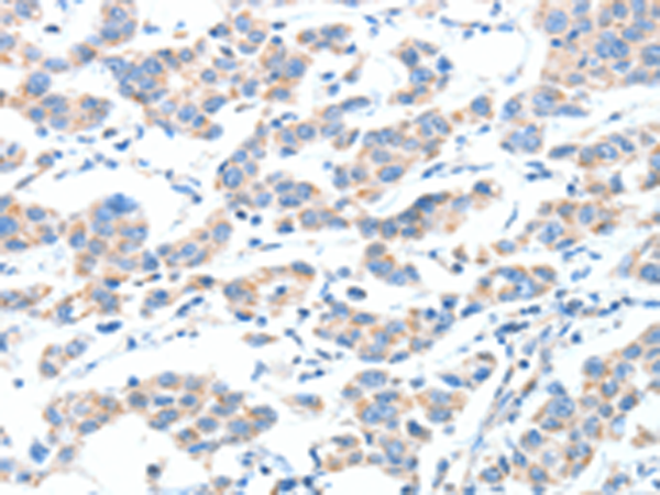 Rabbit Polyclonal Antibody to XBP1