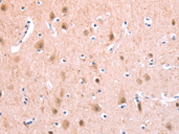 Rabbit Polyclonal Antibody to BMPR2