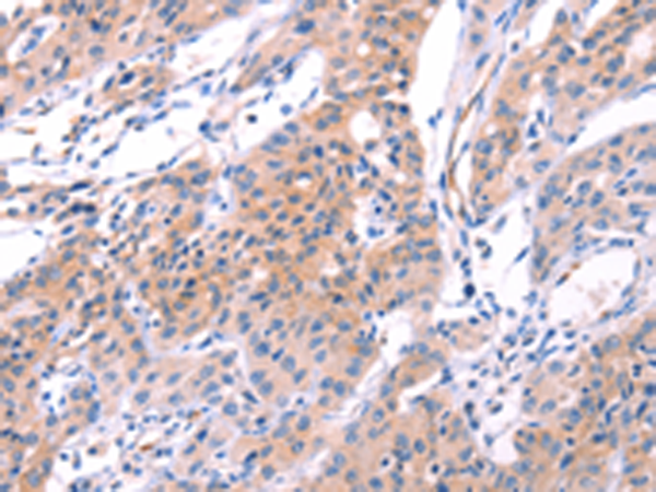 Rabbit Polyclonal Antibody to VWF