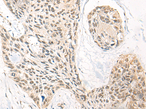 Rabbit Polyclonal Antibody to DNTT