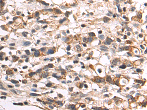 Rabbit Polyclonal Antibody to VDR