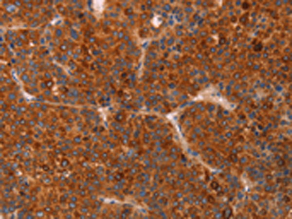 Rabbit Polyclonal Antibody to GC
