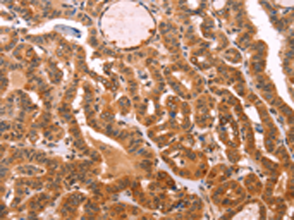 Rabbit Polyclonal Antibody to PROS1