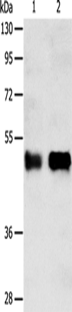Rabbit Polyclonal Antibody to SERPINA5