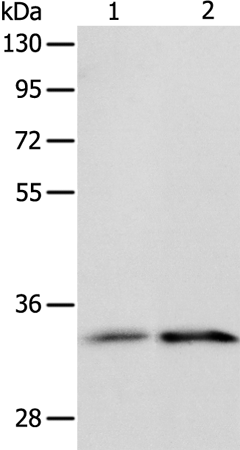 Rabbit Polyclonal Antibody to IL1RL1
