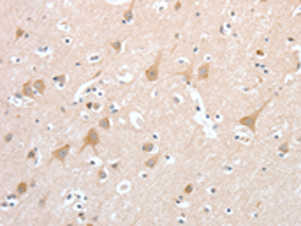 Rabbit Polyclonal Antibody to PCDHB16