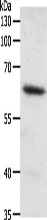 Rabbit Polyclonal Antibody to FZD4