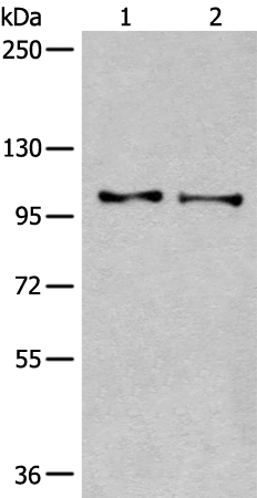 Rabbit Polyclonal Antibody to TMEM67