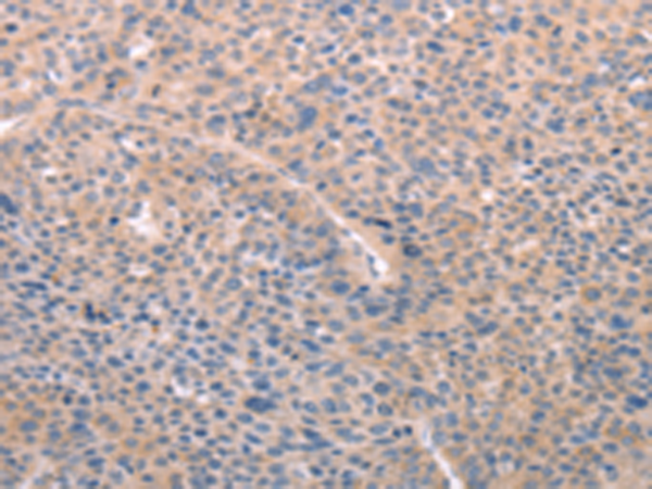 Rabbit Polyclonal Antibody to A4GNT