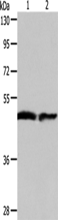Rabbit Polyclonal Antibody to AADAC