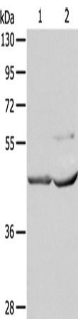 Rabbit Polyclonal Antibody to NCEH1
