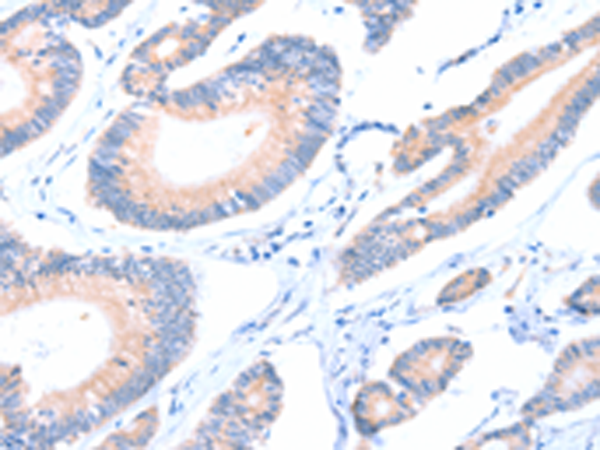 Rabbit Polyclonal Antibody to AADACL2