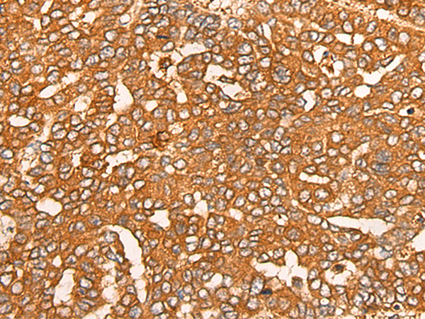 Rabbit Polyclonal Antibody to APEH
