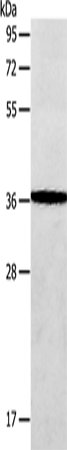 Rabbit Polyclonal Antibody to AASDHPPT