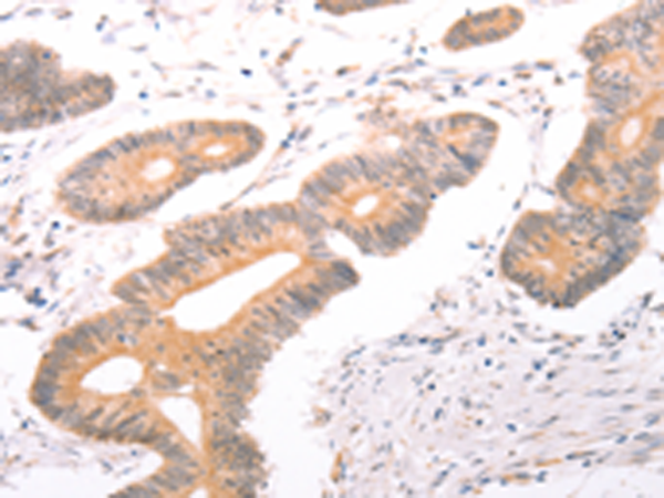 Rabbit Polyclonal Antibody to ABCF2