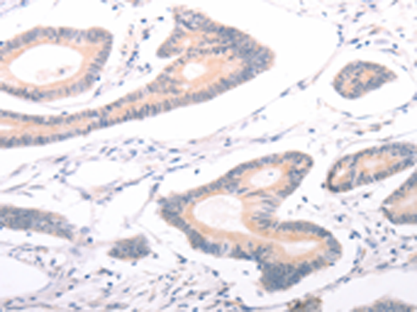 Rabbit Polyclonal Antibody to ABCF3