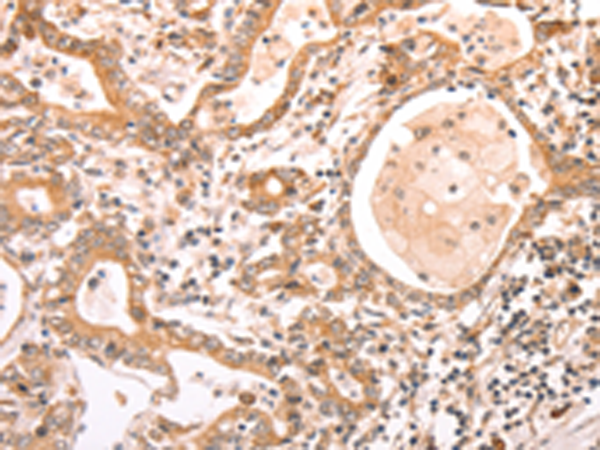 Rabbit Polyclonal Antibody to ABCF1