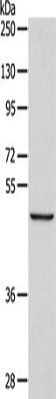 Rabbit Polyclonal Antibody to ALKBH1