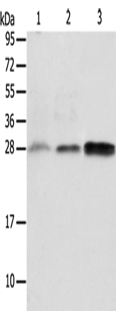 Rabbit Polyclonal Antibody to ALKBH2