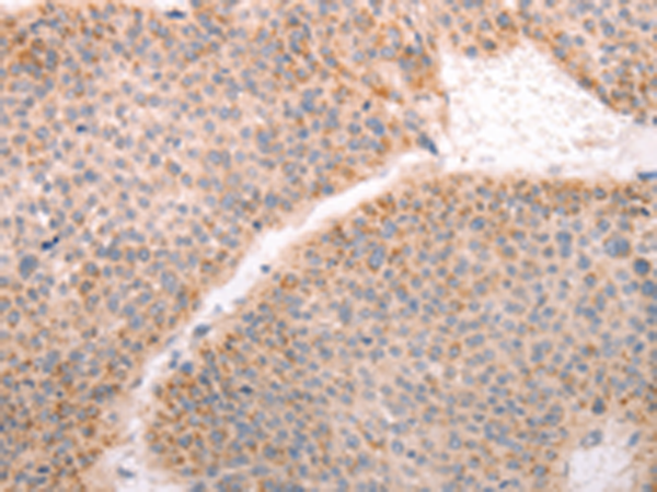 Rabbit Polyclonal Antibody to ABHD12