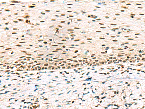 Rabbit Polyclonal Antibody to ABI2