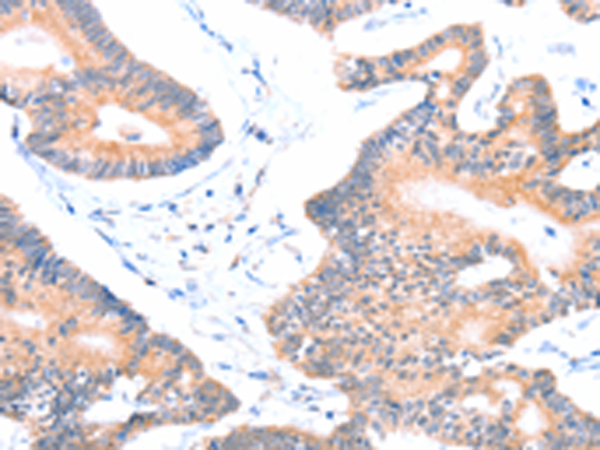 Rabbit Polyclonal Antibody to AOC1
