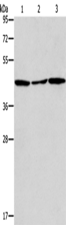 Rabbit Polyclonal Antibody to ACAA2