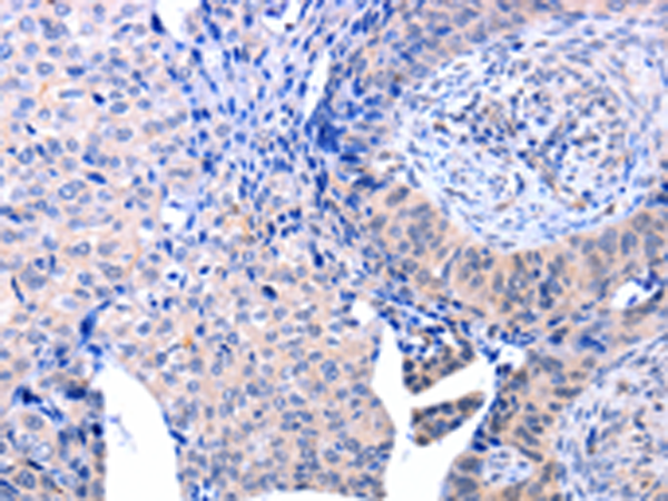 Rabbit Polyclonal Antibody to ACAD10