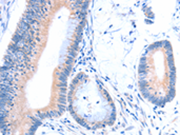 Rabbit Polyclonal Antibody to ACAD8
