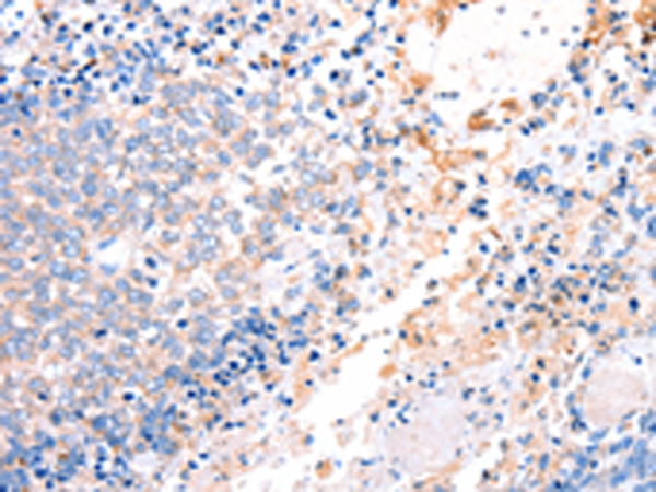 Rabbit Polyclonal Antibody to ACAD9