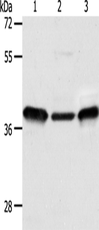 Rabbit Polyclonal Antibody to CNN3
