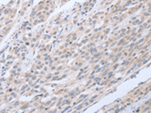 Rabbit Polyclonal Antibody to TNK2