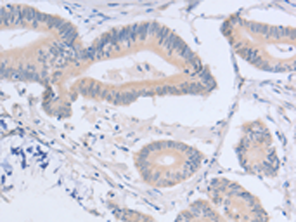 Rabbit Polyclonal Antibody to ACMSD