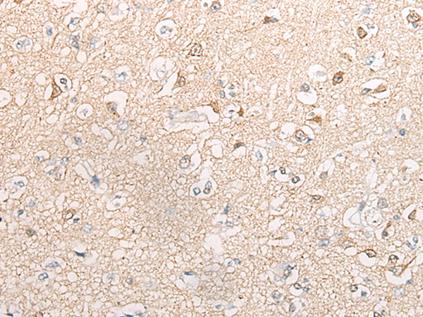 Rabbit Polyclonal Antibody to ACOT7