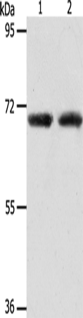 Rabbit Polyclonal Antibody to ACOT11