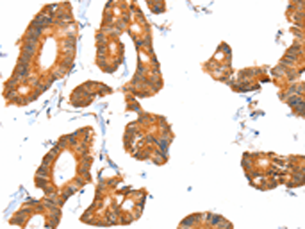 Rabbit Polyclonal Antibody to ACOX1