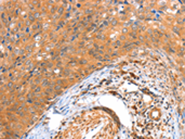 Rabbit Polyclonal Antibody to ACOX3