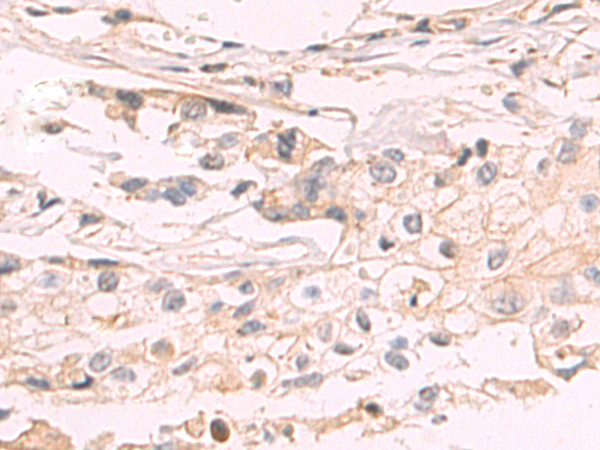 Rabbit Polyclonal Antibody to ACOX2