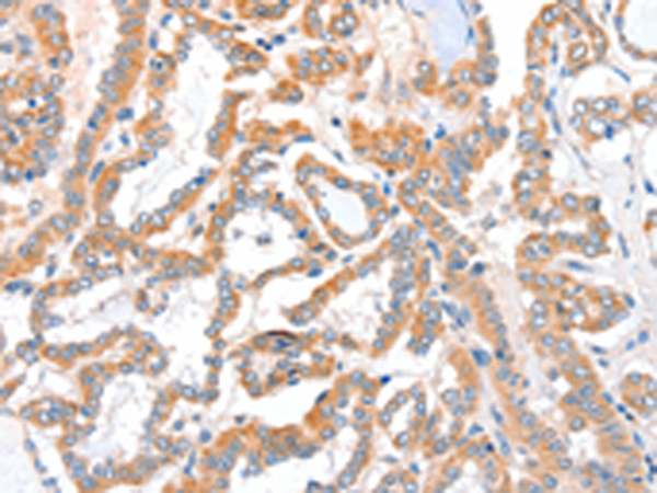 Rabbit Polyclonal Antibody to ACSBG1