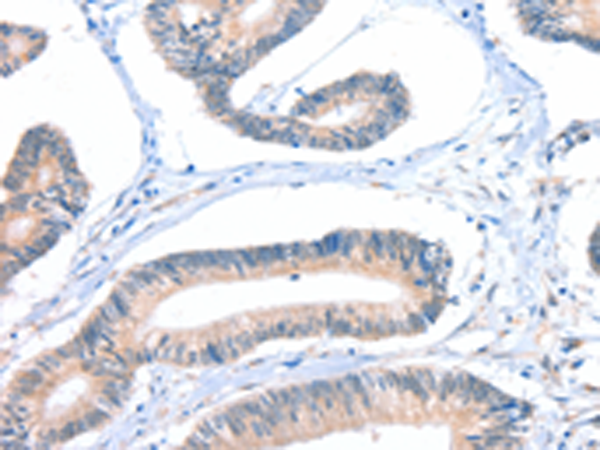 Rabbit Polyclonal Antibody to FHL5