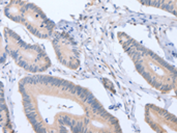 Rabbit Polyclonal Antibody to ACVR1C