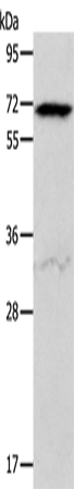 Rabbit Polyclonal Antibody to ACVR2A