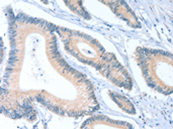 Rabbit Polyclonal Antibody to ACTL7B