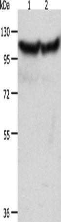 Rabbit Polyclonal Antibody to ACTN3