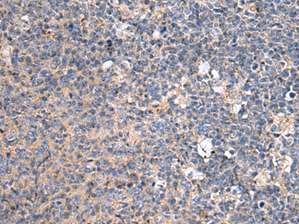 Rabbit Polyclonal Antibody to ACTR1A