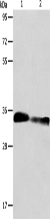 Rabbit Polyclonal Antibody to ACY3