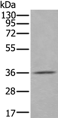 Rabbit Polyclonal Antibody to ACOT8