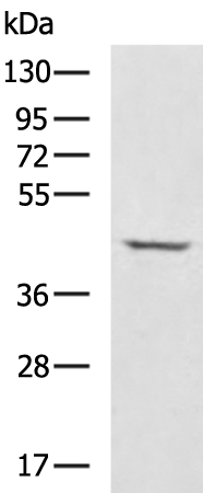 Rabbit Polyclonal Antibody to ADA