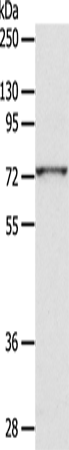 Rabbit Polyclonal Antibody to ADAM10